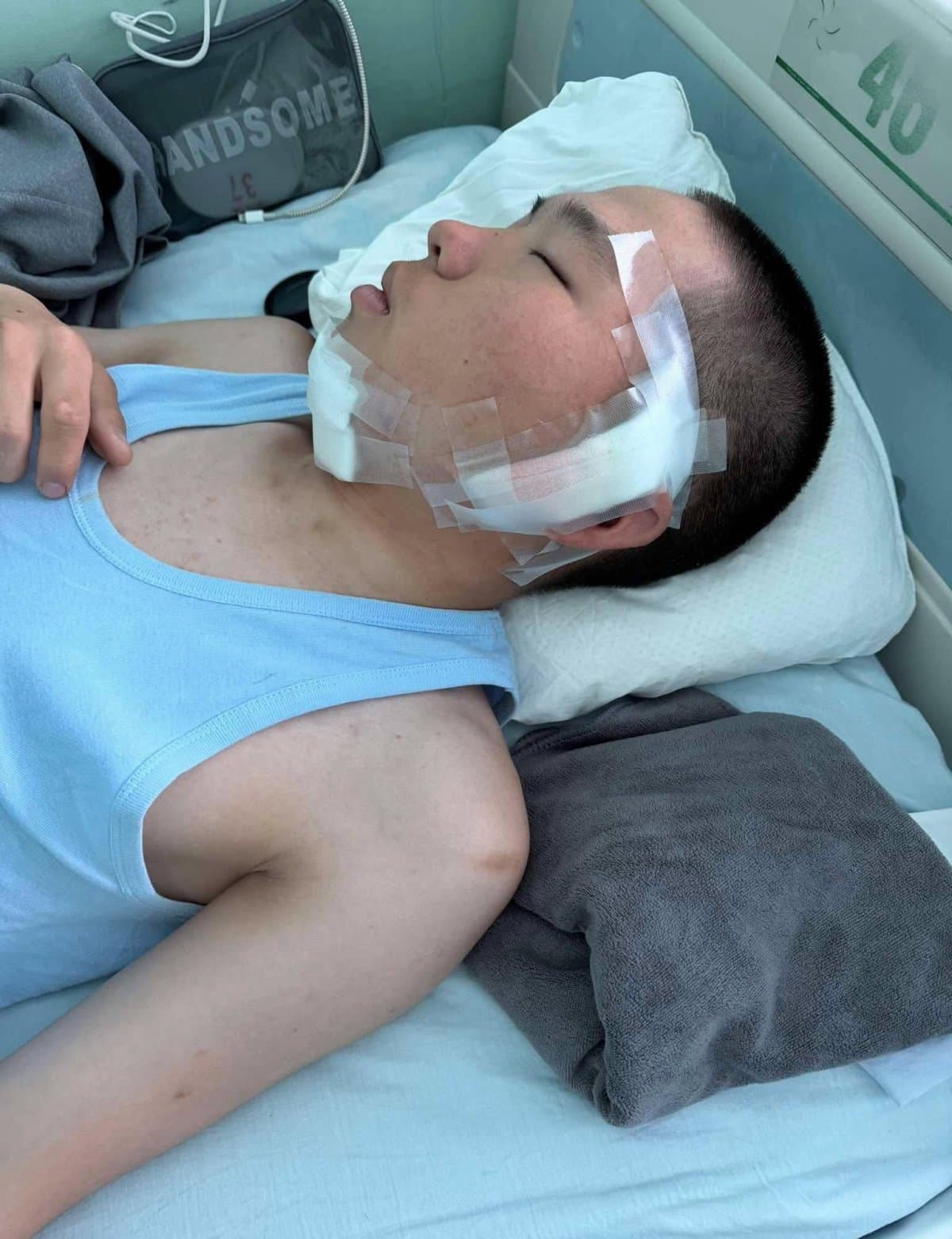 Хилийн 0132 дугаар ангид алба хааж байсан байлдагчийн эрүүг хугалж, шанааг нь цөмлөжээ